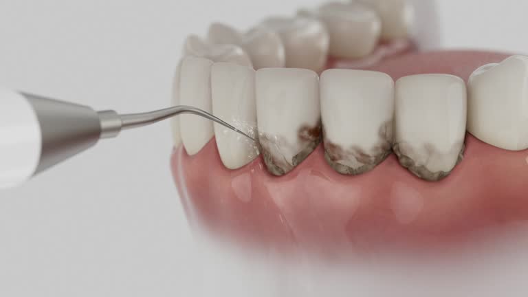 Reliable Dental Implants contractor in Pelham, AL by Smile Center Dentistry
